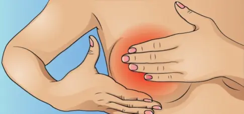 Distinguishing Between Normal and Abnormal Breast Pain