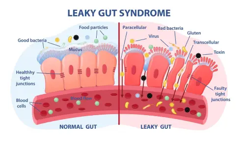 Gut Permeability and Inflammation during Menopause