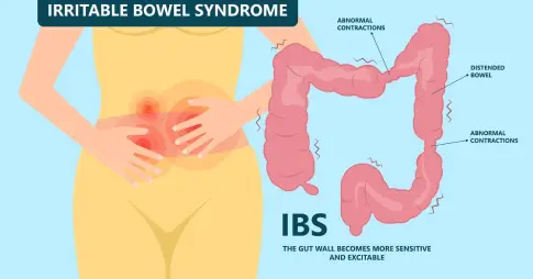 The Gut and Female Reproductive Hormones