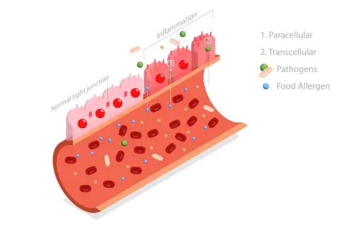 Leaky Gut